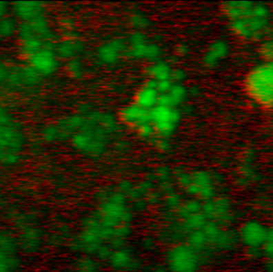 Nonlinear spectroscopy and microscopy based on stimulated Raman scattering for nano and biophotonics applications