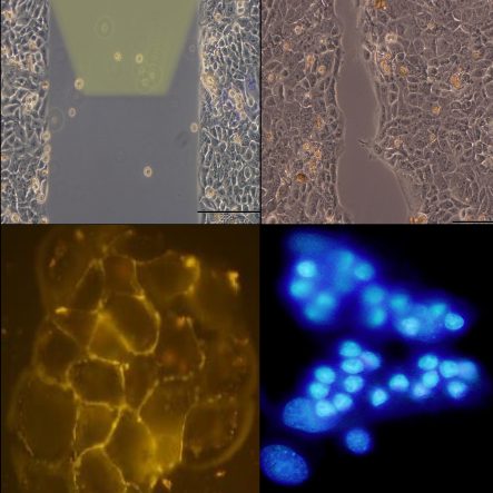 Modulazione ottica della funzione cellulare mediante nanoparticelle fotovoltaiche